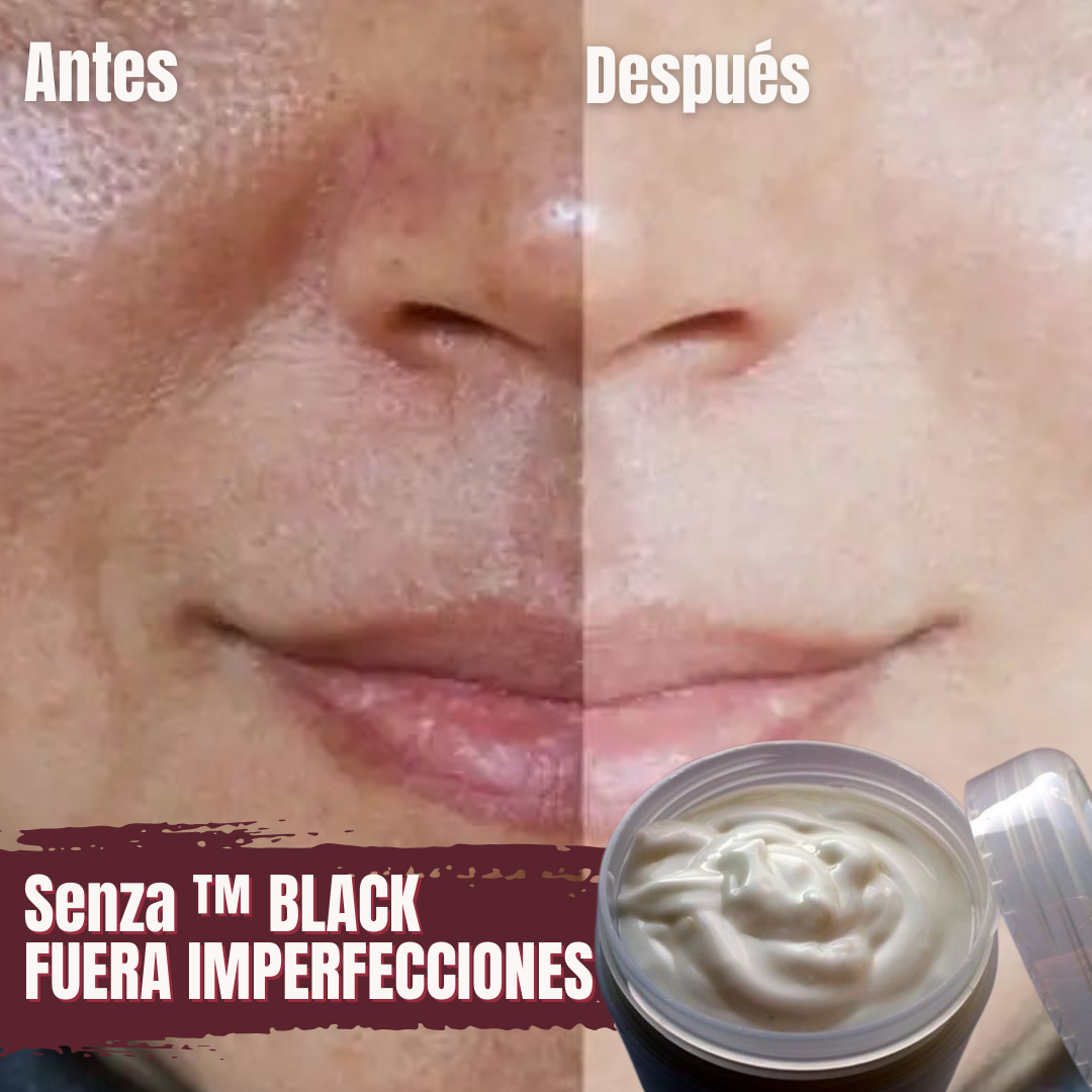 SENZA ™ (BLACK) - Mascarilla Premium de Perla Negra y Carbón Activado